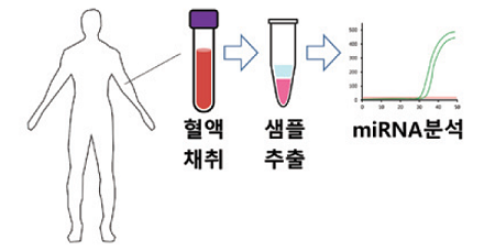 진단키트